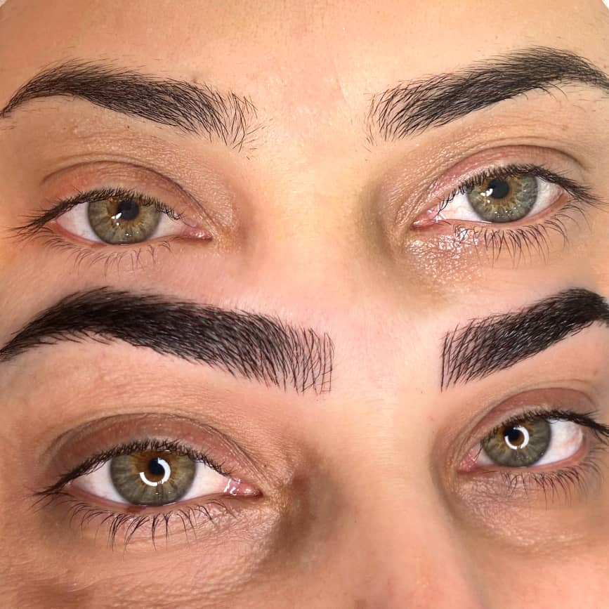 میکروبلیدینگ